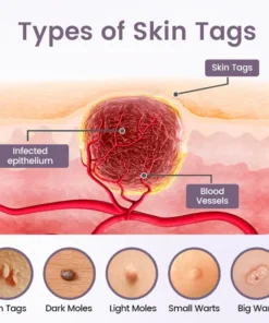 BBOJI® WartSmooth Renewal Serum