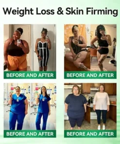 BBOJI™ 10-in-1 Micro-Patch Tech Weight Management Skin Support Visible Results