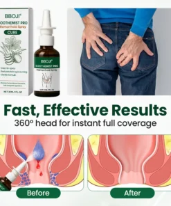 BBOJI® SootheMist PRO Hemorrhoid Spray