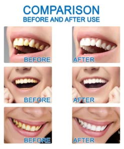 BBOJI™ Teeth Essence Liquid