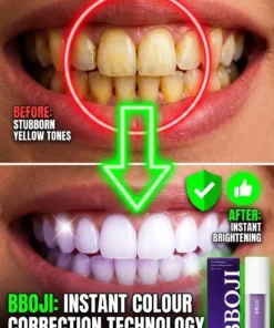 BBOJI Teeth Whitening Gel Colour Corrector