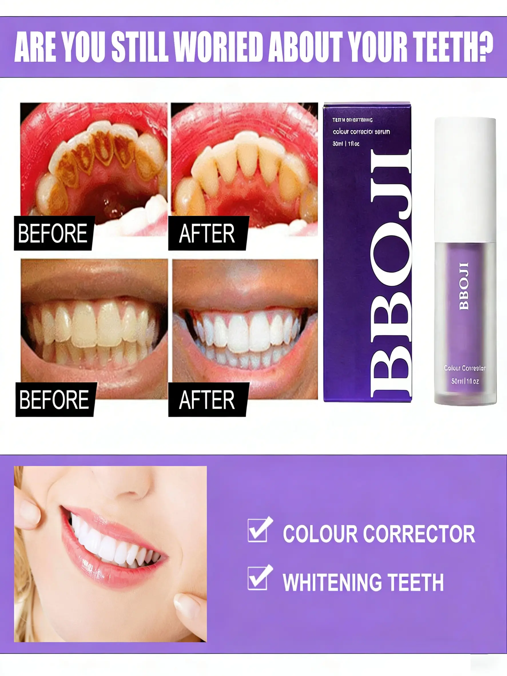 BBOJI Teeth Whitening Gel Colour Corrector