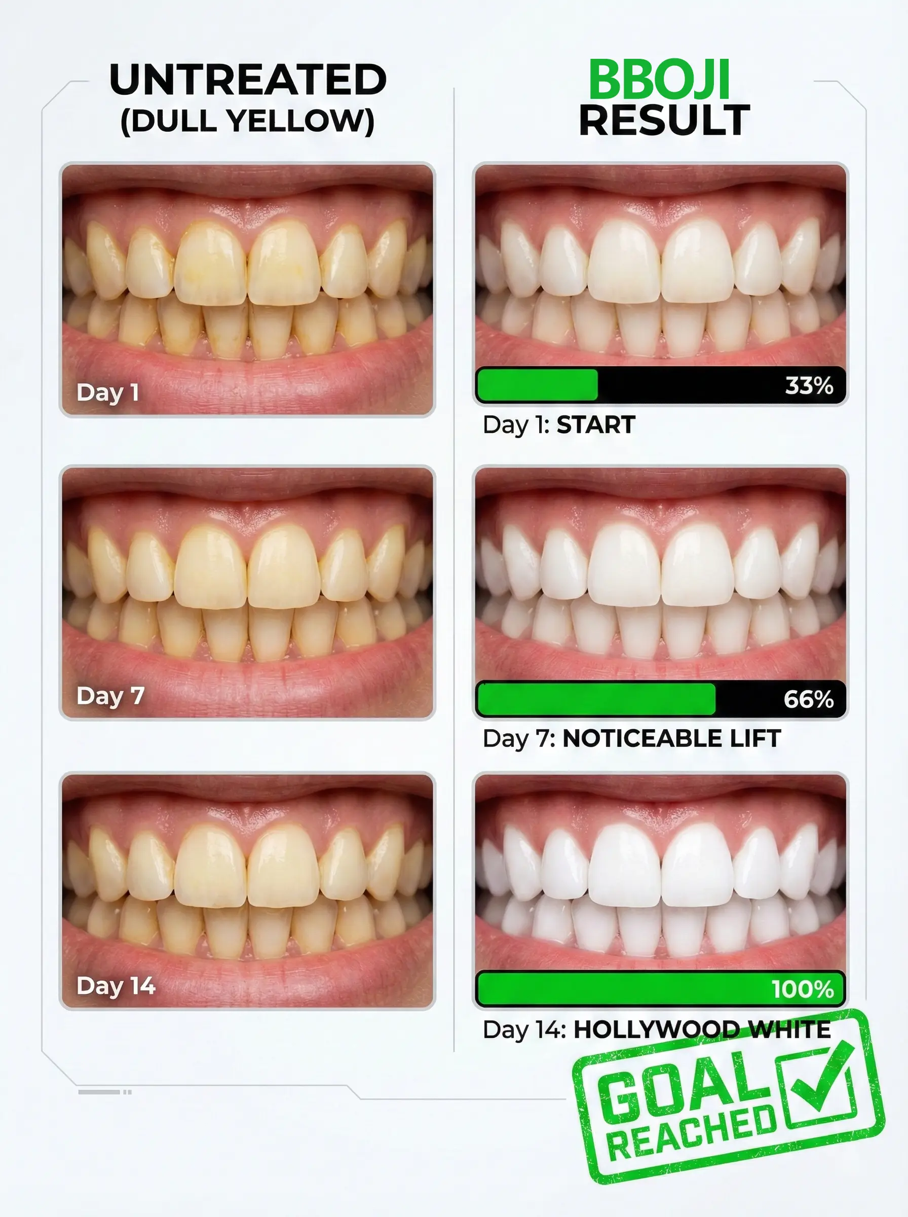 BBOJI Teeth Whitening Gel Colour Corrector