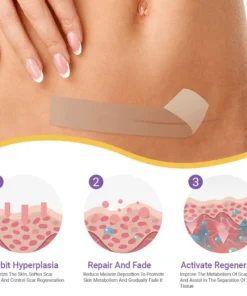 BBOJI® Hyaluronic Acid Nano Microneedle Repair Tape(Treatment of old and new scars, reduction of surgical scars, stretch marks, keloids, acne, burns, warts, dermatomes and varicose veins)