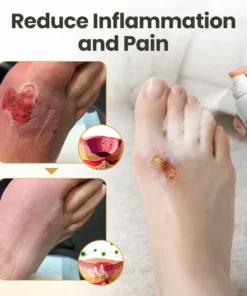 BBOJI™GlucaVeil Foot Shield Spray