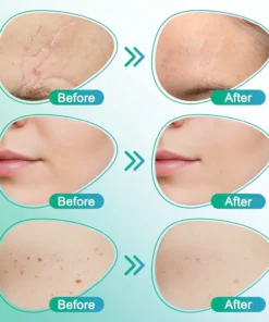 BBOJI® 3-in-1 Microneedle Care Patch