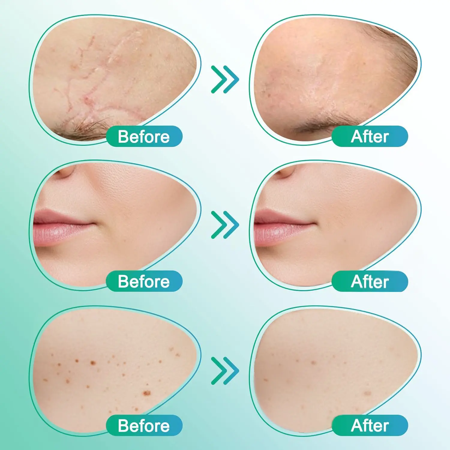 BBOJI® 3-in-1 Microneedle Care Patch