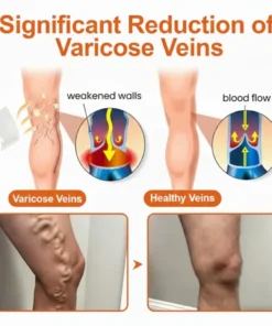 BBOJI® Advanced Micro-Needle Patch Designed for Targeted Leg Comfort Support ,Instant Relief,Long-Term Results