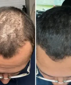 BBOJI™ Hair Growth Serum