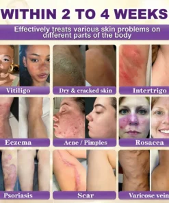 𝐁𝐁𝑶𝑱𝑰® 𝘽𝙞𝙤𝒕𝒊𝒏 10--𝘪𝘯-1 𝘚𝘬𝘪𝘯 𝘙𝘦𝘴𝘵𝘰𝘳𝘢𝘵𝘪𝑜𝑛 𝐶𝑟𝑒𝑎𝑚