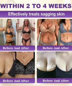 𝐁𝐁𝑶𝑱𝑰® 𝘽𝙞𝙤𝒕𝒊𝒏 10--𝘪𝘯-1 𝘚𝘬𝘪𝘯 𝘙𝘦𝘴𝘵𝘰𝘳𝘢𝘵𝘪𝑜𝑛 𝐶𝑟𝑒𝑎𝑚