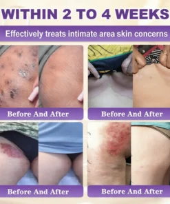 𝐁𝐁𝑶𝑱𝑰® 𝘽𝙞𝙤𝒕𝒊𝒏 10--𝘪𝘯-1 𝘚𝘬𝘪𝘯 𝘙𝘦𝘴𝘵𝘰𝘳𝘢𝘵𝘪𝑜𝑛 𝐶𝑟𝑒𝑎𝑚