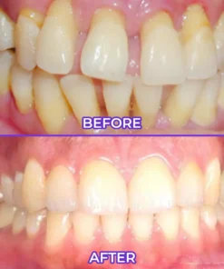 BBOJI™ SensiGum Fluoride Toothpaste