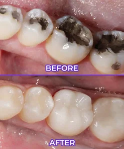 BBOJI™ SensiGum Fluoride Toothpaste