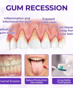 BBOJI™ SensiGum Fluoride Toothpaste