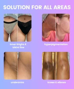 BBOJI™ Skin Brightening Cream