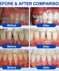 BBOJI® GumRevive Periodontal Repair Gel