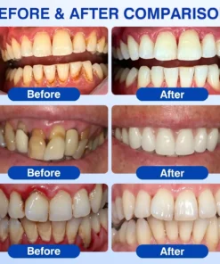 BBOJI® GumRevive Periodontal Repair Gel