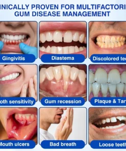 BBOJI® GumRevive Periodontal Repair Gel