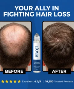 BBOJI Hair Growth Serum Roll on