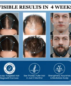 BBOJI Hair Growth Serum Roll on