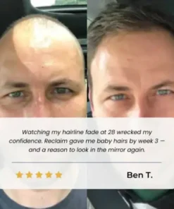 BBOJI Hair Growth Serum Roll on